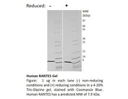 100-138-500UG HUMAN RANTES / CCL5