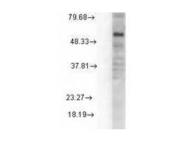 GABAA-RD ANTIBODY 100UG