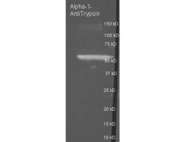 A1AT ANTIBODY BIOTIN 25 UL