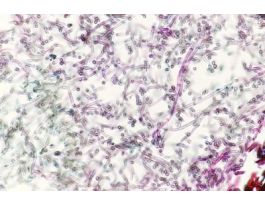 ECTOTROPHIC MYCORRHIZA(CS)QSSHOWING ROOT