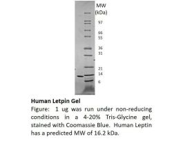 100-37-10MG HUMAN LEPTIN