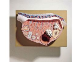 MODEL OVARY