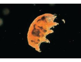 HYPSIBIUS (WATER BEAR) CULTURE 30