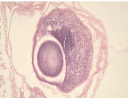 CHICK 96-HOUR TYPICAL SAGITTAL H&E