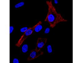 CHOLERA TOXIN B CF594