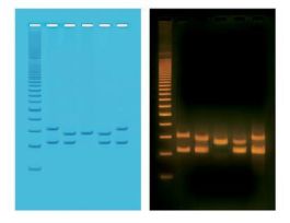 PCR VNTR HUMAN DNA TYPING KIT