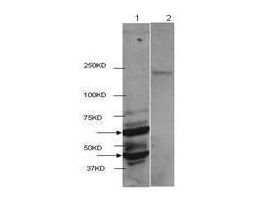 HDAC2 ANTIBODY 100 UG