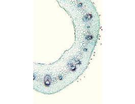 BUTTERCUP (RANUNCULUS) STEM CS