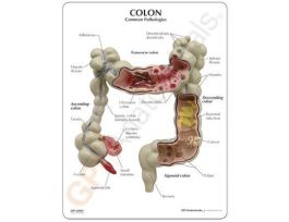 MODEL COLON