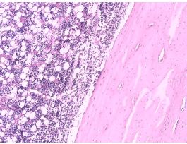BONE-COMPACT(CS&LS)H&E DECALCIFIED&STAIN