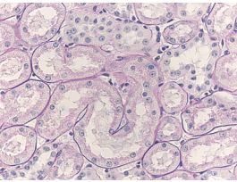 KIDNEY (SECT) PAS&H (HUMAN)