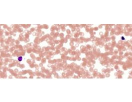 HUMAN BLOOD (SM) GS SLIDE