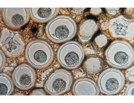 CENTRIOLES(SECT)IH MITOTIC TISSUE