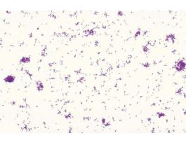 AGROBACTERIUM TUMEFACIENS G-CAUSES CROWN