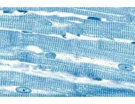 CARDIAC MUSCLE (CS&LS) 1.5UM IH