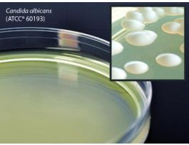 MEDIUM SABDEX AGAR W/LEC/TWN80 PLTD PK10