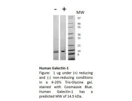 100-30-500UG HUMAN GALECTIN-1