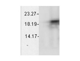 CRYAB ANTIBODY 200UG