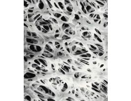 FILTER MEMB DISC 5UM PVC 47MM DM PK100