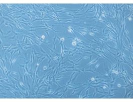 HBSMC-c: Human Bronchial Smooth Muscle Cells (HBSMC)