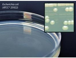 MEDIUM NUTRIENT AGAR 15X100MM PLATE PK10