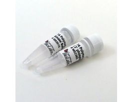 T4 POLYNUCLEOTIDE KINASE 1000U