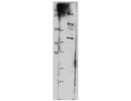 ABCB8 ANTIBODY 100 UL