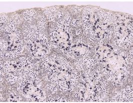 FROG-TESTIS (CS) IH SPERMATOGENESIS.