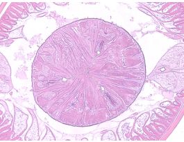 ASCARIS LUMBRICOIDES (CS)H&E
