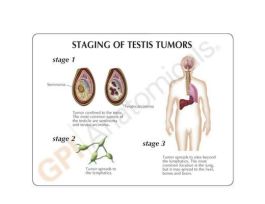 MODEL BASIC MALE PELVIS