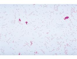 FD KLEBSIELLA PNEUMONIAE W/MEDIA