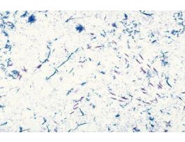 CORYNEBACTERIUM DIPHTHERIAE (SM)G(+)