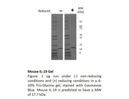 200-75-1MG MOUSE IL-19
