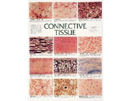 CHART WALL CONNECTIVE TISSUE