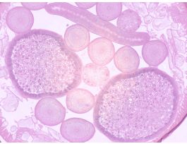 ASCARIS CS OF FEMALE