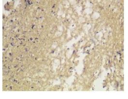 GRAM MCDONALD'S KIT 100RXN