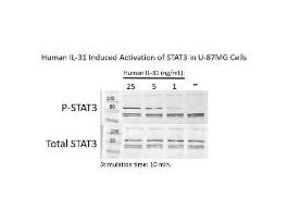 RECOM E.COLI HUMAN IL-31 >/=95% 5UG