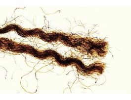 BLOOD STAINED TEXTILE FIBERS (WM)