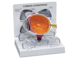 MODEL EYE CORNEA: NORMAL 3 CONDITIONS