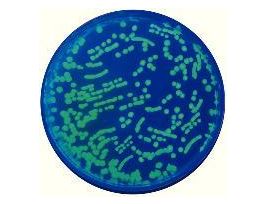 TRANSFORMATION OF E COLI W GFP