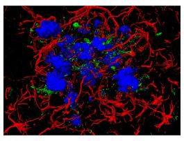 AMYLO-GLO AMYLOID PLAQUE STAIN REAGENT