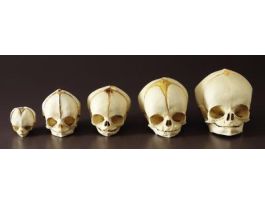 MODEL FETAL HUMAN SKULLS SET/5.