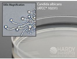 CORN MEAL AGAR W/TWEEN 80 15X100MM PLATE