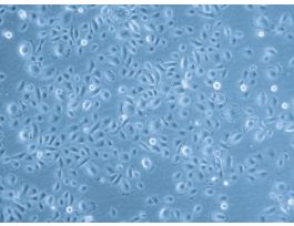HTEpC-c: Human Tracheal Epithelial Cells (HTEpC)