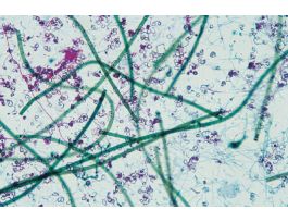 BLUE-GREEN ALGAE MIXED WM WARDS