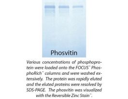 KIT FOCUS PHOSPHORICH 5PREPS