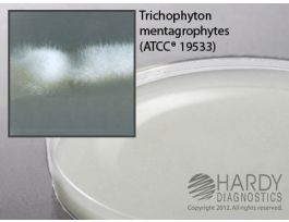 AGAR POTATO FLAKE SELECTIVE 15X100MM PLT