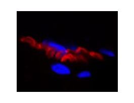 ALPHA-BUNGAROTOXIN CF568