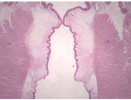 LARYNX-(SECT) H&E M FRONTAL SECTION