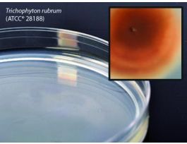 MEDIUM POTATO DEX AGAR PLATED 68ML PK10